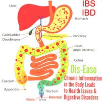 Cure for Fissures Inflammation Coilitis, bartholin gland cyst proctitis Digestion tract diagram anal fissure hemorrhoids and stomach